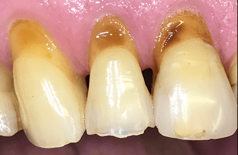 Odontología conservadora antes