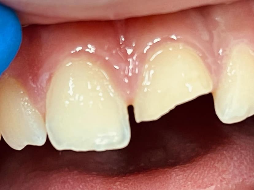 Odontología conservadora antes