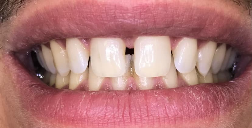 Odontología conservadora antes
