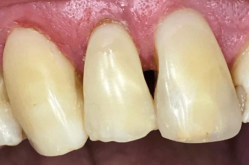 Odontología conservadora después