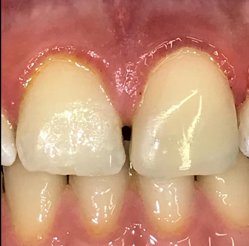 Odontología conservadora después