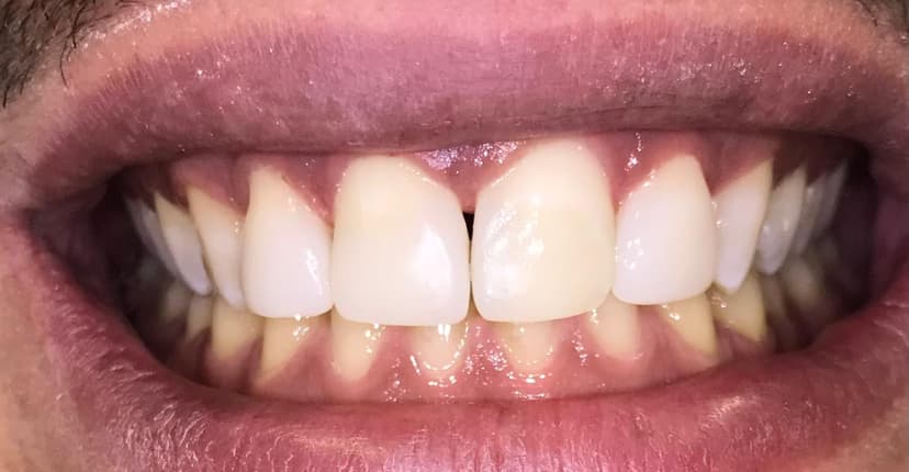 Odontología conservadora después
