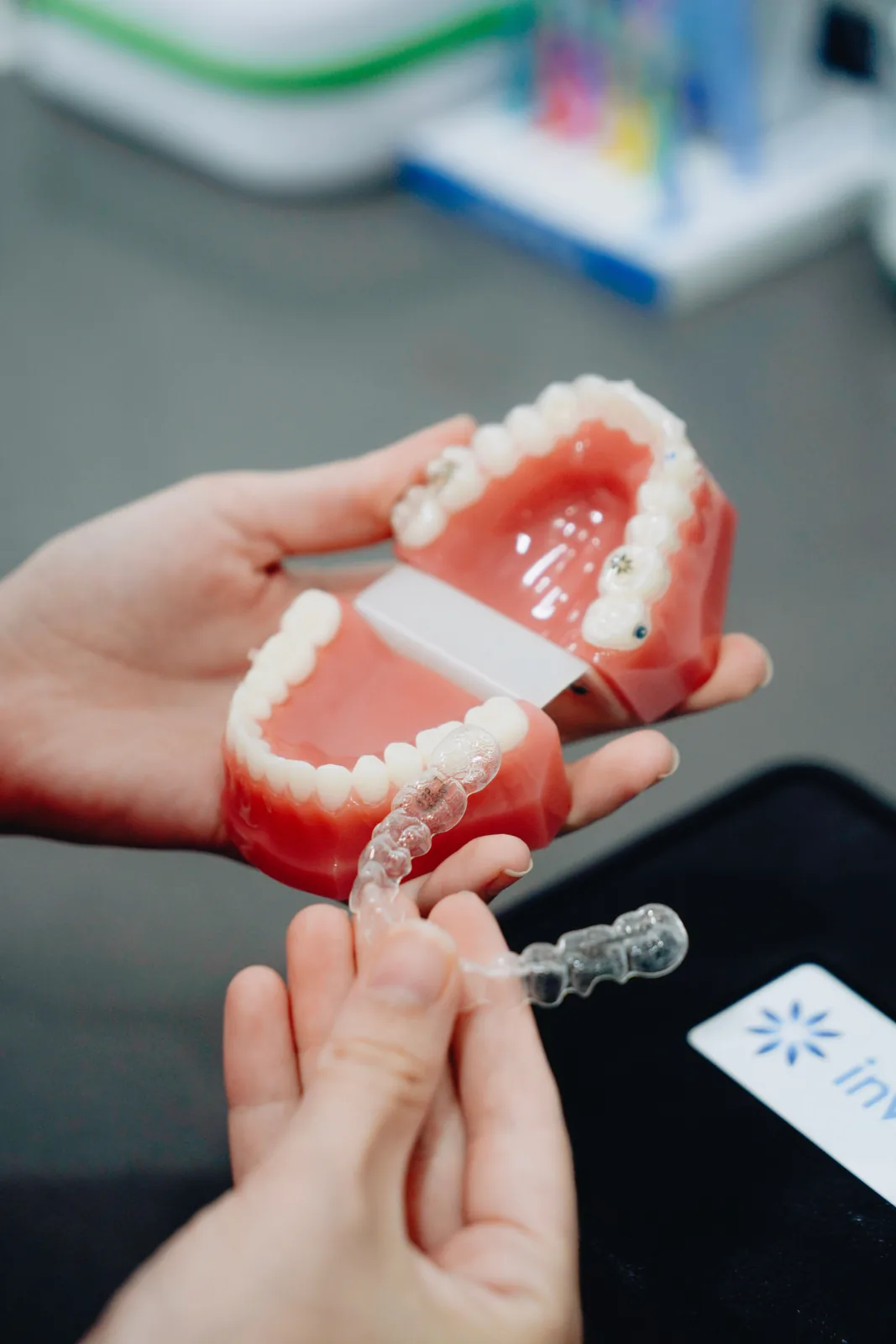 Modelo dental y alineador transparente para el estudio de ortodoncia en Abad Dental Logroño